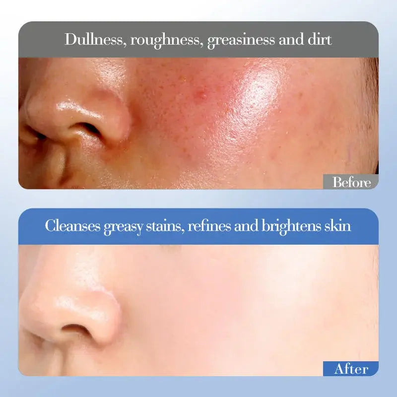 Crème visage hydratante niacinamide et au riz